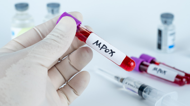 OMS sustituye nombre de viruela del mono por mpox