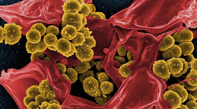 Bacterias mortales se sienten atraídas por la sangre humana